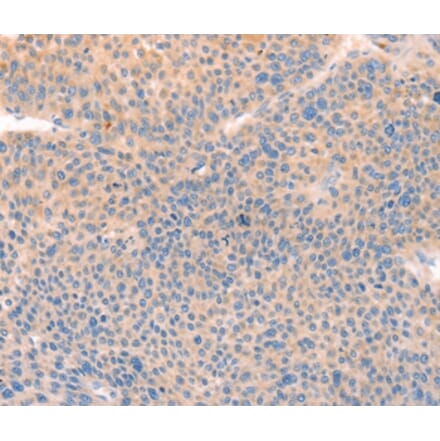 Immunohistochemistry - CD109 Antibody from Signalway Antibody (37154) - Antibodies.com