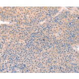 Immunohistochemistry - CD109 Antibody from Signalway Antibody (37154) - Antibodies.com