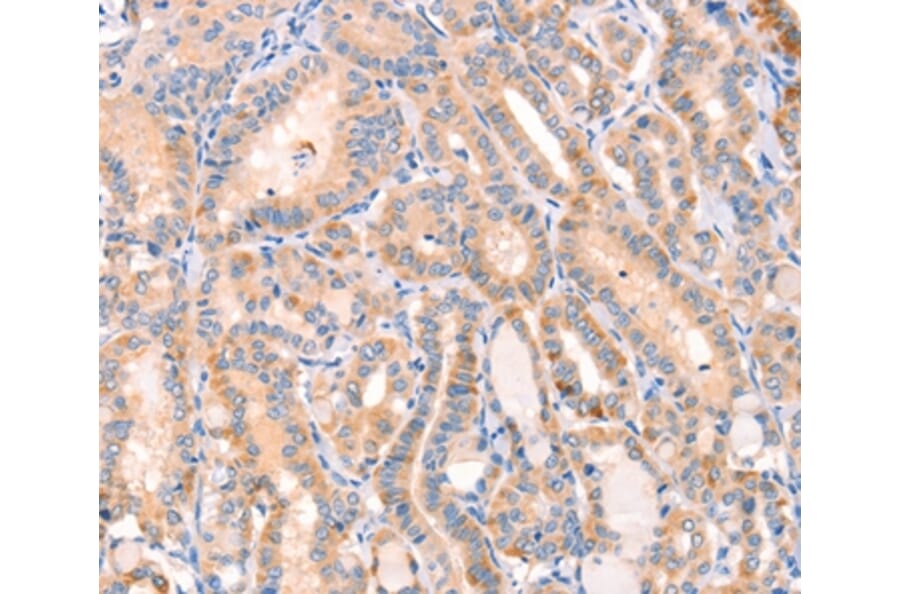Immunohistochemistry - CD109 Antibody from Signalway Antibody (37154) - Antibodies.com