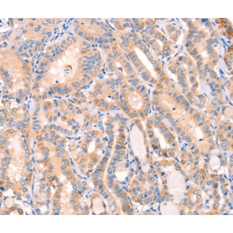 Immunohistochemistry - CD109 Antibody from Signalway Antibody (37154) - Antibodies.com