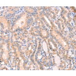 Immunohistochemistry - CD109 Antibody from Signalway Antibody (37154) - Antibodies.com