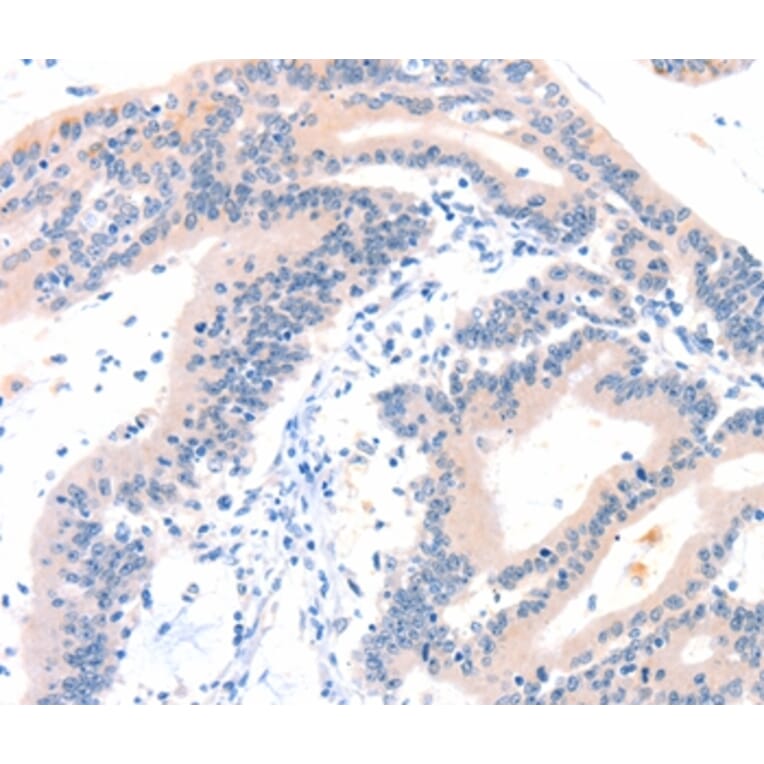 Immunohistochemistry - ITGA6 Antibody from Signalway Antibody (37155) - Antibodies.com