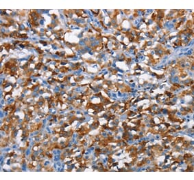 Immunohistochemistry - CD226 Antibody from Signalway Antibody (37161) - Antibodies.com