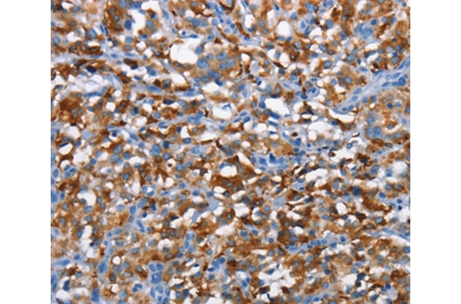 Immunohistochemistry - CD226 Antibody from Signalway Antibody (37161) - Antibodies.com