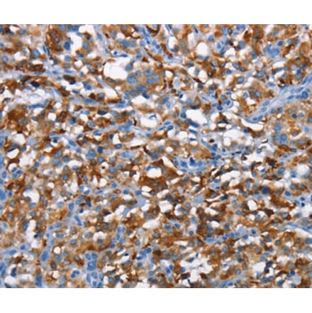 Immunohistochemistry - CD226 Antibody from Signalway Antibody (37161) - Antibodies.com