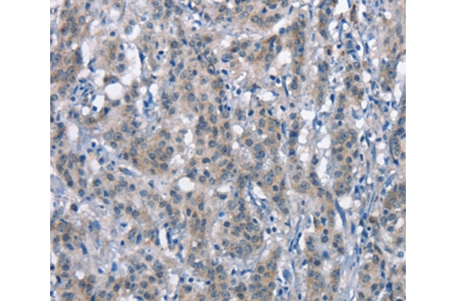 Immunohistochemistry - CD226 Antibody from Signalway Antibody (37161) - Antibodies.com