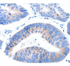 Immunohistochemistry - MUC3A Antibody from Signalway Antibody (37170) - Antibodies.com