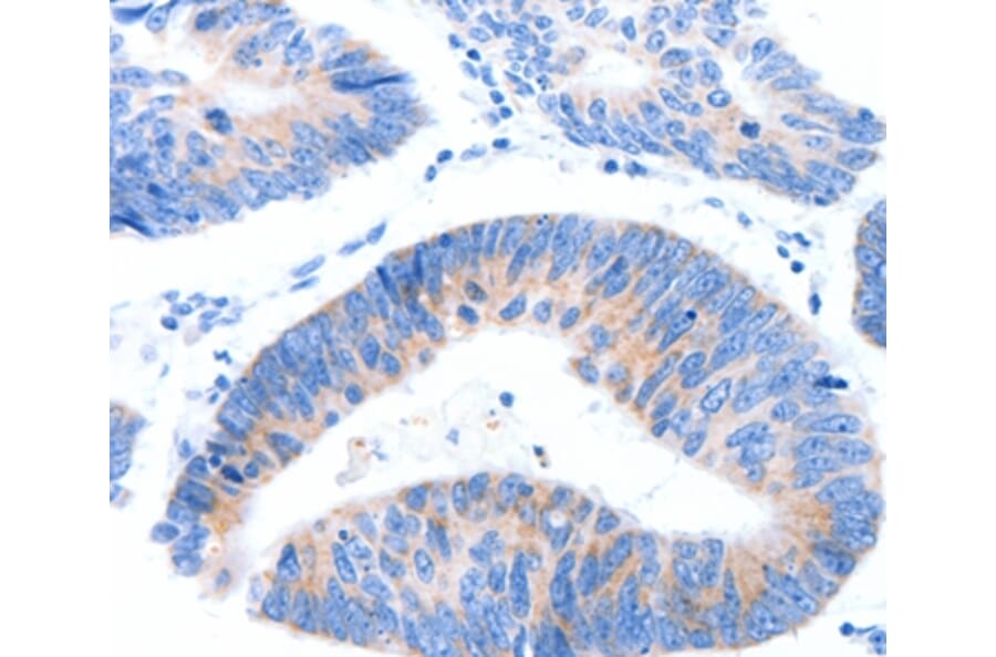 Immunohistochemistry - MUC3A Antibody from Signalway Antibody (37170) - Antibodies.com