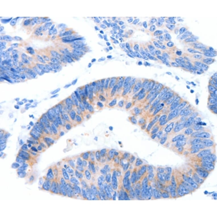 Immunohistochemistry - MUC3A Antibody from Signalway Antibody (37170) - Antibodies.com