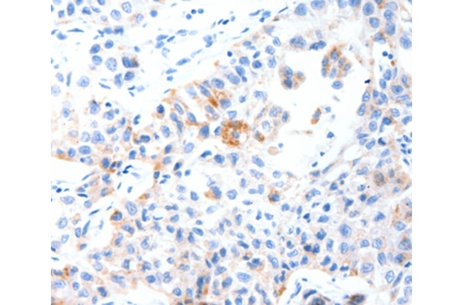 Immunohistochemistry - MUC3A Antibody from Signalway Antibody (37170) - Antibodies.com