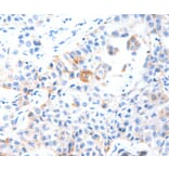 Immunohistochemistry - MUC3A Antibody from Signalway Antibody (37170) - Antibodies.com