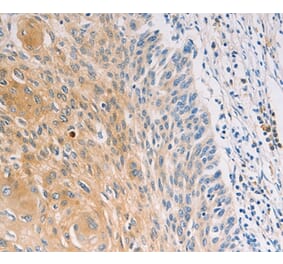 Immunohistochemistry - MUC5B Antibody from Signalway Antibody (37171) - Antibodies.com