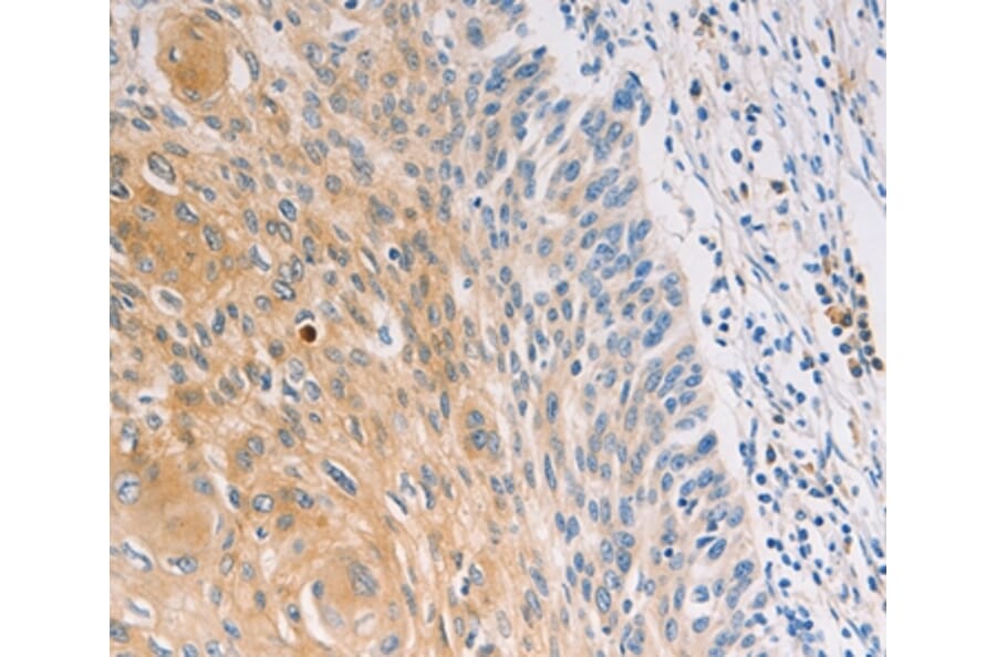 Immunohistochemistry - MUC5B Antibody from Signalway Antibody (37171) - Antibodies.com