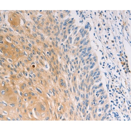 Immunohistochemistry - MUC5B Antibody from Signalway Antibody (37171) - Antibodies.com