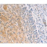 Immunohistochemistry - MUC5B Antibody from Signalway Antibody (37171) - Antibodies.com