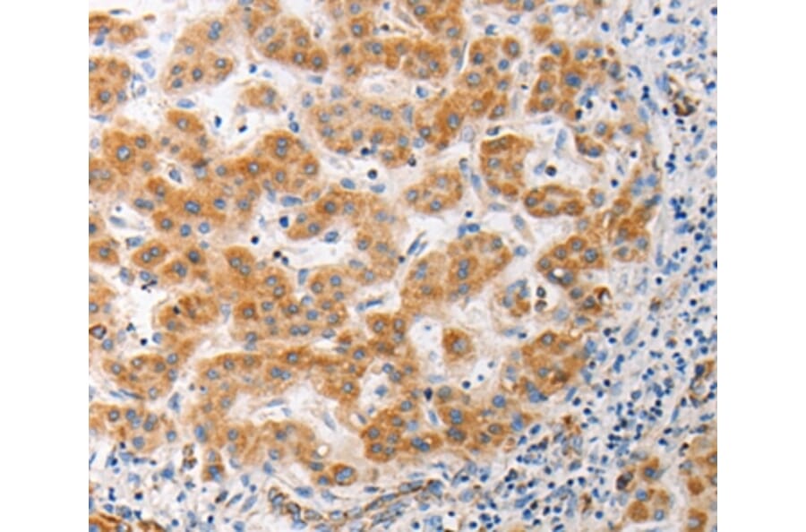 Immunohistochemistry - MUC13 Antibody from Signalway Antibody (37172) - Antibodies.com