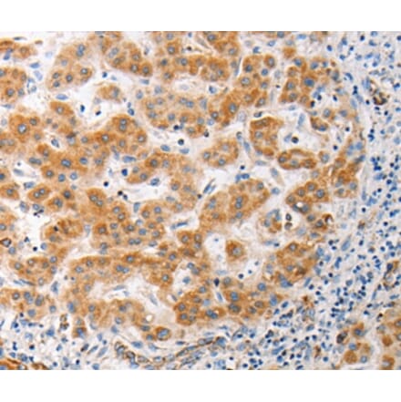 Immunohistochemistry - MUC13 Antibody from Signalway Antibody (37172) - Antibodies.com