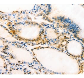 Immunohistochemistry - MUC16 Antibody from Signalway Antibody (37173) - Antibodies.com