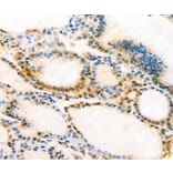 Immunohistochemistry - MUC16 Antibody from Signalway Antibody (37173) - Antibodies.com