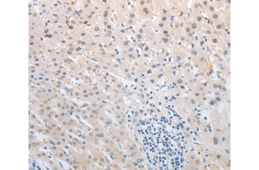 Immunohistochemistry - NFAT5 Antibody from Signalway Antibody (37180) - Antibodies.com