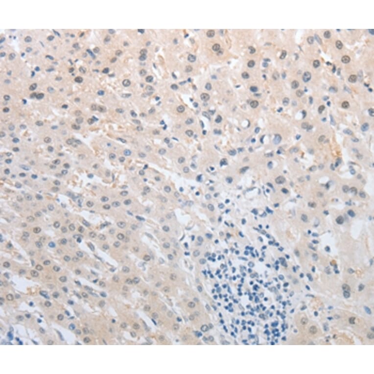 Immunohistochemistry - NFAT5 Antibody from Signalway Antibody (37180) - Antibodies.com