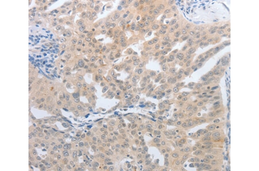 Immunohistochemistry - NFAT5 Antibody from Signalway Antibody (37180) - Antibodies.com