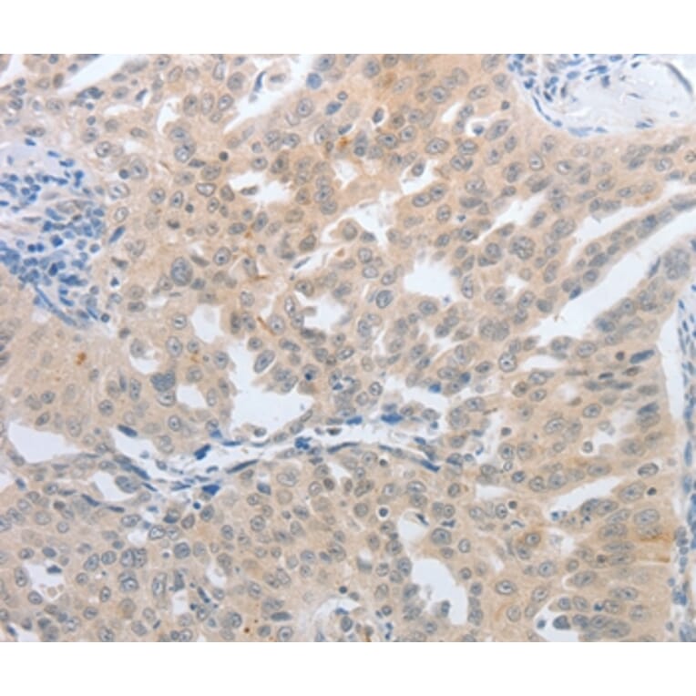 Immunohistochemistry - NFAT5 Antibody from Signalway Antibody (37180) - Antibodies.com