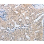 Immunohistochemistry - NFAT5 Antibody from Signalway Antibody (37180) - Antibodies.com