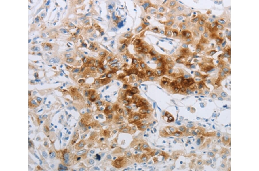 Immunohistochemistry - NPY2R Antibody from Signalway Antibody (37197) - Antibodies.com