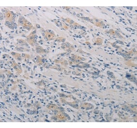 Immunohistochemistry - PTAFR Antibody from Signalway Antibody (37204) - Antibodies.com