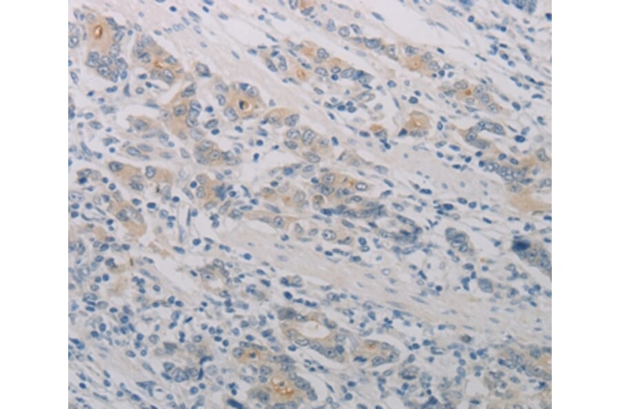 Immunohistochemistry - PTAFR Antibody from Signalway Antibody (37204) - Antibodies.com