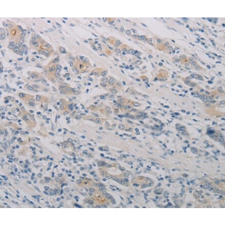 Immunohistochemistry - PTAFR Antibody from Signalway Antibody (37204) - Antibodies.com