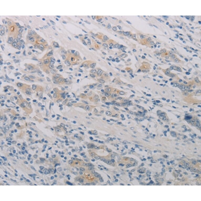 Immunohistochemistry - PTAFR Antibody from Signalway Antibody (37204) - Antibodies.com