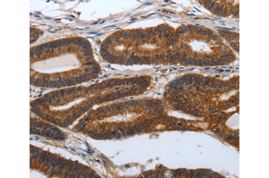 Immunohistochemistry - PDCD7 Antibody from Signalway Antibody (37209) - Antibodies.com