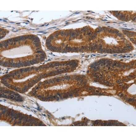 Immunohistochemistry - PDCD7 Antibody from Signalway Antibody (37209) - Antibodies.com