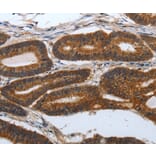 Immunohistochemistry - PDCD7 Antibody from Signalway Antibody (37209) - Antibodies.com
