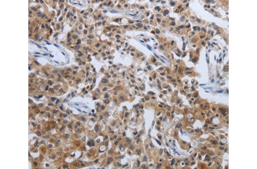 Immunohistochemistry - PDCD7 Antibody from Signalway Antibody (37209) - Antibodies.com