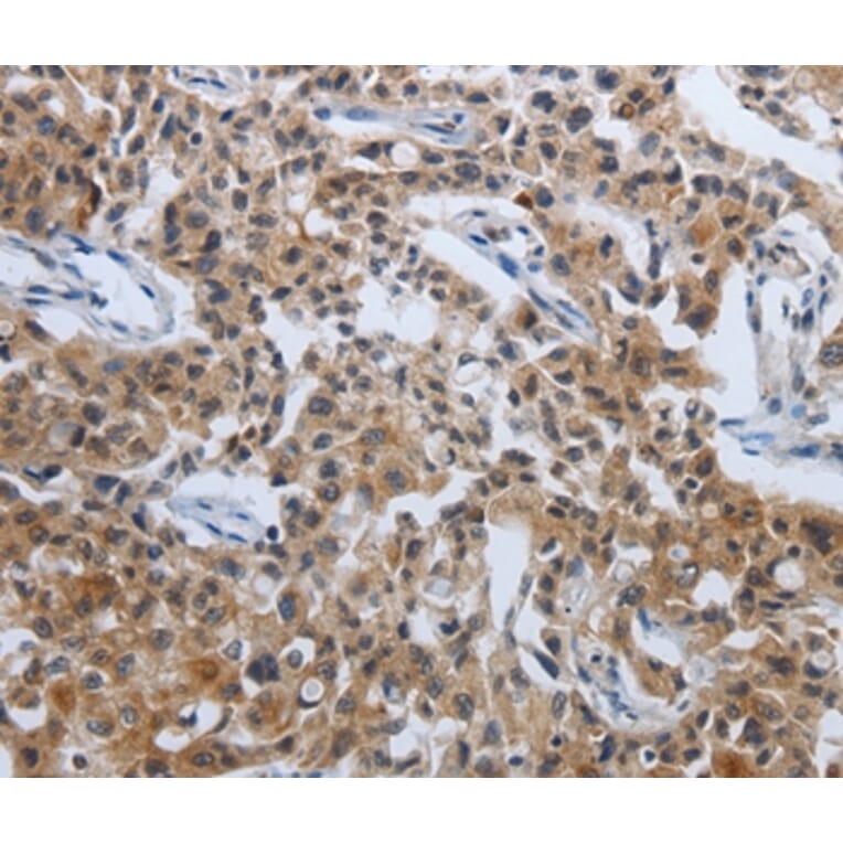 Immunohistochemistry - PDCD7 Antibody from Signalway Antibody (37209) - Antibodies.com