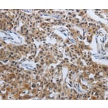 Immunohistochemistry - PDCD7 Antibody from Signalway Antibody (37209) - Antibodies.com