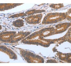 Immunohistochemistry - PODXL Antibody from Signalway Antibody (37211) - Antibodies.com