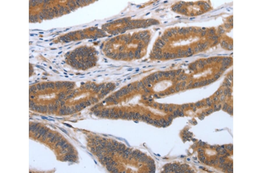 Immunohistochemistry - PODXL Antibody from Signalway Antibody (37211) - Antibodies.com