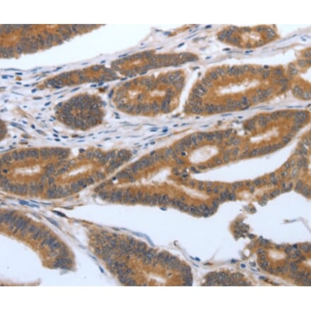 Immunohistochemistry - PODXL Antibody from Signalway Antibody (37211) - Antibodies.com