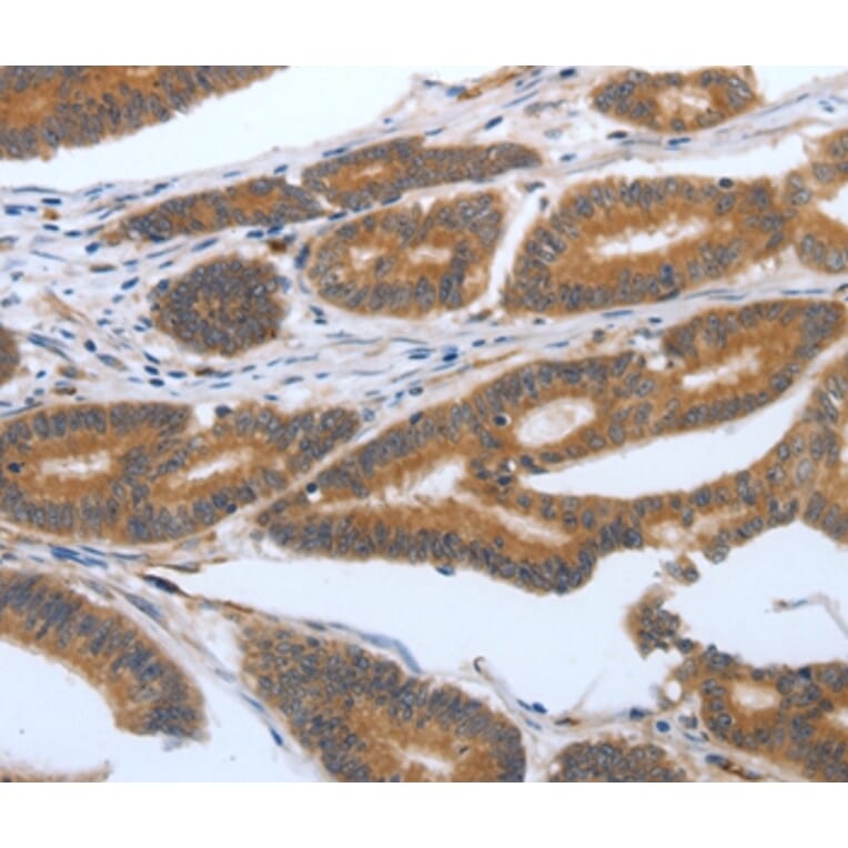 Immunohistochemistry - PODXL Antibody from Signalway Antibody (37211) - Antibodies.com