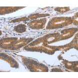 Immunohistochemistry - PODXL Antibody from Signalway Antibody (37211) - Antibodies.com