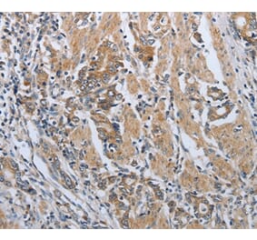 Immunohistochemistry - PDCD1 Antibody from Signalway Antibody (37212) - Antibodies.com