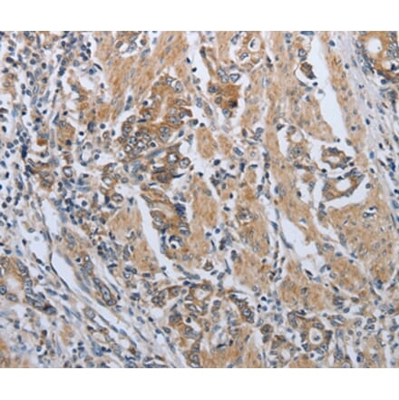 Immunohistochemistry - PDCD1 Antibody from Signalway Antibody (37212) - Antibodies.com
