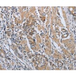 Immunohistochemistry - PDCD1 Antibody from Signalway Antibody (37212) - Antibodies.com