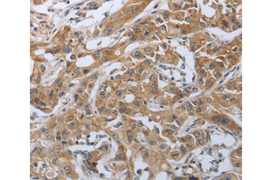 Immunohistochemistry - PDCD1 Antibody from Signalway Antibody (37212) - Antibodies.com