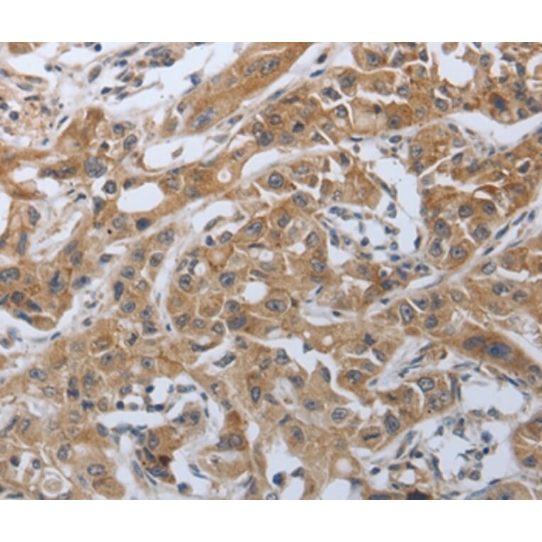 Immunohistochemistry - PDCD1 Antibody from Signalway Antibody (37212) - Antibodies.com