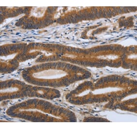 Immunohistochemistry - PDGFA Antibody from Signalway Antibody (37213) - Antibodies.com